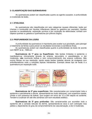 2- CLASSIFICAÇÃO DAS QUEIMADURAS

       As queimaduras podem ser classificadas quanto ao agente causador, à profundidade
e à extensão da lesão.


2.1- ETIOLOGIA

       As queimaduras são classificadas em seis categorias causais diferentes: lesão por
chamas e combustão por líquidos inflamáveis (álcool ou gasolina por exemplo); líquidos
quentes ou escaldaduras; exposição química e por condução de eletricidade; contato com
objetos quentes ou gelados e queimaduras por pólvora (fogos).


2.2- PROFUNDIDADE DA LESÃO

       A profundidade da queimadura é importante para avaliar sua gravidade, para planejar
o tratamento da ferida e para prever os resultados funcionais e cosméticos finais.
       As queimaduras podem ser classificadas quanto à profundidade da lesão de acordo
com NERY et al., 1998 em:

        Queimaduras de 1º grau ou Superficiais: São lesões limitadas à epiderme e
manifestam-se clinicamente através de eritema, secundário à vasodilatação, e dor
moderada, não ocorrendo bolhas e nem comprometimento dos anexos cutâneos. Não
ocorre fibrose na sua resolução, sendo essas lesões tratadas através de analgesia com
antiinflamatórios orais e soluções tópicas hidratantes. Exemplo desse tipo de lesão é a
queimadura por exposição solar.




      Queimaduras de 2º grau superficiais: São caracterizadas por comprometer toda a
epiderme e parcialmente a derme, apresentando-se muito dolorosas, com superfície rosada,
úmida e com presença de bolhas, que surgem em torno de 12 a 24h depois do acidente.
Tendem a cicatrizar em até três semanas com bom resultado estético.

       Queimaduras de 2º grau profundas: São caracterizadas por acometer toda a
epiderme até a camada reticular da derme, apresentando-se seca e com coloração rosa
pálida e, dependendo do grau de comprometimento da vascularização, a dor é moderada.



                                            281
 