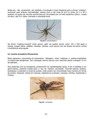 deitar-se), não produzindo dor imediata. A evolução é mais freqüente para a forma "cutânea",
evoluindo para eritema (vermelhidão), edema duro e dor local (6 a12 h); entre 24 h e 36 h
aparece um ponto de necrose central (escuro) circundado por um halo isquêmico (claro) – Lesão
em álvo;; até 72 h, febre, mal-estar e ulceração local.




                                       Fig 23.5 – Aranha Marrom.

Na forma "cutâneo-visceral" (mais grave), além do quadro acima, entre 12h e 24h após a
picada, surgem febre, cefaléia, náuseas, vômitos, urina escura (cor de lavado de carne), anúria
e isuficiência renal aguda.


9.2. Aranha Armadeira (Phoneutria)

Muito agressiva, encontrada em bananeiras, folhagens, entre madeiras e pedras empilhadas
no interior das residências. Tem coloração marrom escura com manchas claras e atingem 12 cm
de diâmetro.

Nos acidentes com as armadeiras, predominam as manifestações locais. A dor é imediata e em
geral intensa, podendo irradiar para a raiz do membro acometido. Ocorrem edema, eritema,
parestesia e sudorese no local da picada, onde podem ser encontradas duas marcas em forma
de pontos. Especial- mente em crianças, registram-se sudorese, náuseas, vômitos, hipotensão e
choque.




                                     Fig 23.6 – Armadeira..




                                             322
 