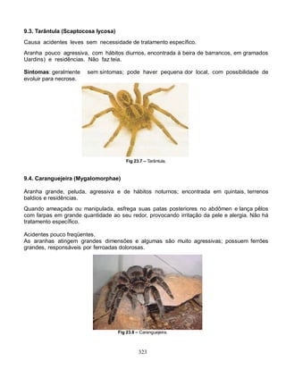 9.3. Tarântula (Scaptocosa Iycosa)
Causa acidentes leves sem necessidade de tratamento específico.
Aranha pouco agressiva, com hábitos diurnos, encontrada à beira de barrancos, em gramados
Uardins) e residências. Não faz teia.

Sintomas: geralmente    sem sintomas; pode haver pequena dor local, com possibilidade de
evoluir para necrose.




                                         Fig 23.7 – Tarântula.


9.4. Caranguejeira (Mygalomorphae)

Aranha grande, peluda, agressiva e de hábitos noturnos; encontrada em quintais, terrenos
baldios e residências.
Quando ameaçada ou manipulada, esfrega suas patas posteriores no abdômen e lança pêlos
com farpas em grande quantidade ao seu redor, provocando irritação da pele e alergia. Não há
tratamento específico.

Acidentes pouco freqüentes.
As aranhas atingem grandes dimensões e algumas são muito agressivas; possuem ferrões
grandes, responsáveis por ferroadas dolorosas.




                                     Fig 23.8 – Caranguejeira.



                                               323
 