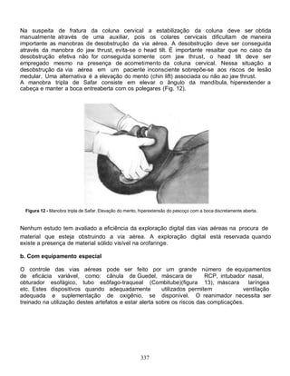 Na suspeita de fratura da coluna cervical a estabilização da coluna deve ser obtida
manualmente através de uma auxiliar, pois os colares cervicais dificultam de maneira
importante as manobras de desobstrução da via aérea. A desobstrução deve ser conseguida
através da manobra do jaw thrust, evita-se o head tilt. É importante resaltar que no caso da
desobstrução efetiva não for conseguida somente com jaw thrust, o head tilt deve ser
empregado mesmo na presença de acometimento da coluna cervical. Nessa situação a
desobstrução da via aérea em um paciente inconsciente sobrepõe-se aos riscos de lesão
medular. Uma alternativa é a elevação do mento (chin lift) associada ou não ao jaw thrust.
A manobra tripla de Safar consiste em elevar o ângulo da mandíbula, hiperextender a
cabeça e manter a boca entreaberta com os polegares (Fig. 12).




  Figura 12 - Manobra tripla de Safar. Elevação do mento, hiperextensão do pescoço com a boca discretamente aberta.


Nenhum estudo tem avaliado a eficiência da exploração digital das vias aéreas na procura de
material que esteja obstruindo a via aérea. A exploração digital está reservada quando
existe a presença de material sólido visível na orofaringe.

b. Com equipamento especial

O controle das vias aéreas pode ser feito por um grande número de equipamentos
de eficácia variável, como: cânula de Guedel, máscara de                  RCP, intubador nasal,
obturador esofágico, tubo esôfago-traqueal (Combitube)(figura 13), máscara                laríngea
etc. Estes dispositivos quando adequadamente             utilizados permitem            ventilação
adequada e suplementação de oxigênio, se disponível. O reanimador necessita ser
treinado na utilização destes artefatos e estar alerta sobre os riscos das complicações.




                                                          337
 