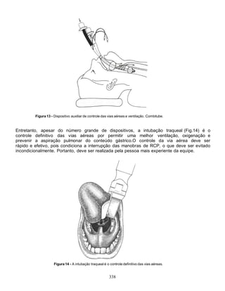 Figura 13 - Dispositivo auxiliar de controle das vias aéreas e ventilação. Combitube.



Entretanto, apesar do número grande de dispositivos, a intubação traqueal (Fig.14) é o
controle definitivo das vias aéreas por permitir uma melhor ventilação, oxigenação e
prevenir a aspiração pulmonar do conteúdo gástrico.O controle da via aérea deve ser
rápido e efetivo, pois condiciona a interrupção das manobras de RCP, o que deve ser evitado
incondicionalmente. Portanto, deve ser realizada pela pessoa mais experiente da equipe.




                     Figura 14 - A intubação traqueal é o controle definitivo das vias aéreas.


                                                          338
 