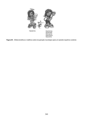 Figura 39   Efeitos benéficos e maléficos sobre recuperação neurológica após um episódio isquêmico cerebral.




                                                           360
 