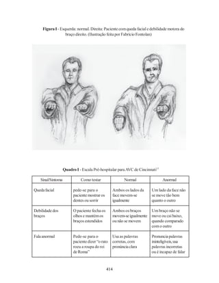 Figura I - Esquerda: normal. Direita: Paciente com queda facial e debilidade motora do
                   braço direito. (Ilustração feita por Fabrício Fontolan)




                   Quadro I - Escala Pré-hospitalar para AVC de Cincinnati17

   Sinal/Sintoma             Como testar                Normal                 Anormal

Queda facial             pede-se para o           Ambos os lados da     Um lado da face não
                         paciente mostrar os      face movem-se         se move tão bem
                         dentes ou sorrir         igualmente            quanto o outro

Debilidade dos           O paciente fecha os      Ambos os braços       Um braço não se
braços                   olhos e mantém os        movem-se igualmente   move ou cai baixo,
                         braços estendidos        ou não se movem       quando comparado
                                                                        com o outro

Fala anormal             Pede-se para o           Usa as palavras       Pronuncia palavras
                         paciente dizer “o rato   corretas, com         ininteligíveis, usa
                         roeu a roupa do rei      pronúncia clara       palavras incorretas
                         de Roma”                                       ou é incapaz de falar



                                               414
 