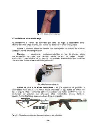 Fig 4.19 – Lesão por arma branca.


5.2. Ferimentos Por Arma de Fogo

No atendimento a vítimas de acidentes por arma de fogo, o sococorrista tenta
informar-se sobre o tipo da arma, seu calibre e a distância de onde foi disparada.

      Calibre - diâmetro interno do tambor, que corresponde ao calibre da munição
usada por aquela arma em particular.
      Munição     - usualmente projéteis construídos em liga de chumbo sólido
que apresentam ou não uma jaqueta parcial de aço ou cobre; formato
arredondado, chato, cônico ou pontiagudo; extremidade anterior do projétil macio ou
côncavo para favorecer expansão e fragmentação.




                                        Fig 4.20 – Revolver calibre .38.

      Armas de alta e de baixa velocidade - as que aceleram os projéteis a
velocidades mais baixas são menos letais, incluindo-se aqui todas as armas de
mão e alguns rifles. Ferimentos com essas armas são menos destrutivos que os
produzidos por projéteis que alcançam altas velocidades, embora também
causem ferimentos letais, dependendo da área de impacto.




Fig 4.21 – Rifles altamente letais que disparam projéteis em alta velocidade.


                                                    - 68 -
 