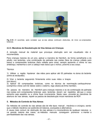 Fig. 8.10 - O socorrista, após constatar que as vias aéreas continuam obstruídas, dá início as compressões
torácicas.


4.2.3. Manobras de Desobstrução de Vias Aéreas em Crianças

A remoção manual de material que provoque obstrução sem ser visualizado não é
recomendada.
Para crianças maiores de um ano, aplicar a manobra de Heimlich, de forma semelhante a do
adulto; nos lactentes, uma combinação de palmada nas costas (face da criança voltada para
baixo) e compressões torácicas (face voltada para cima), sempre apoiando a vítima no seu
antebraço; mantenha-o com a cabeça mais baixa que o tronco, próximo a seu corpo.

Técnica:

1) Utilizar a região hipotenar das mãos para aplicar até 05 palmadas no dorso do lactente
(entre as escápulas);
2) Virar o lactente segurando firmemente entre suas mãos e braços
(em bloco);
3) Aplicar 05 compressões torácicas, como na técnica de reanimação cardiopulmonar
(comprima o tórax com 02 dedos sobre o esterno, logo abaixo,da linha mamilar).

Os passos da manobra de Heimlich para crianças maiores e os da combinação de palmada
nas costas com compressões torácicas para lactentes devem ser repetidos até que o corpo
estranho seja expelido ou a vítima fique inconsciente. Neste caso, proceder as manobras de
abertura de vias aéreas, repetir os passos de desobstrução iniciar manobras de RCP.

5. Métodos de Controle de Vias Aéreas

Os métodos de controle de vias aéreas são de três tipos: manual , mecânico e cirúrgico, sendo
que o método mecânico se subdivide em básicos, avançados e alternativos.
A causa mais comum de obstrução de vias aéreas é a inconsciência de qualquer natureza e,
na grande maioria dos casos, os métodos manuais conseguem promover e manter a
permeabilidade das vias aéreas.

                                                  - 97 -
 
