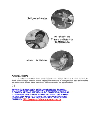 AVALIAÇÃO INICIAL
A avaliação Inicial tem como objetivo reconhecer e corrigir situações de risco imediato de
morte. Inclui avaliação das vias aéreas, respiração e ventilação. A avaliação inicial deve ser realizada
em menos de um minuto, a não ser que seja necessário intervir em algum momento.
(...)
ESTE É UM MODELO DE DEMONSTRAÇÃO DA APOSTILA
E CONTÉM APENAS UM TRECHO DO CONTEÚDO ORIGINAL.
O DESENVOLVIMENTO DA MATÉRIA CONTINUA POR MAIS
PÁGINAS NA APOSTILA COMPLETA, QUE VOCÊ PODERÁ
OBTER EM http://www.acheiconcursos.com.br .
 
