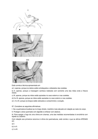 Está correta a técnica apresentada em
a) I, apenas, porque os dedos estão entrelaçados e afastados das costelas.
b) II, apenas, porque a massagem cardíaca realizada com somente uma das mãos evita a fratura
óssea.
c) III, apenas, porque as mãos estão apoiadas no osso externo e nas costelas.
d) II e III, apenas, porque as mãos estão apoiadas no osso externo e nas costelas.
e) I, II e III, porque os braços estão esticados e comprimindo o coração.
87. Considere as seguintes afirmativas:
I. Se a queimadura localizar-se no braço direito, mantê-lo mais elevado em relação ao resto do corpo.
II. Proteger a área queimada com algodão e enfaixar com atadura.
III. Para apagar o fogo de uma vítima em chamas, uma das medidas recomendadas é envolvê-la com
tapete ou cobertor.
Com relação aos primeiros socorros à vítima de queimaduras, está correto o que se afirma APENAS
em
a) I.
b) I e II.
c) I e III.
 