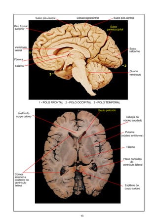 Ventrículo
lateral
Quarto
ventrículo
Cornos
anterior e
posterior do
ventrículo
lateral
Fórnice
Tálamo
Sulco
parietoccipital
Sulco
calcarino
Giro frontal
superior
1
2
3
1 - POLO FRONTAL 2 - POLO OCCIPITAL 3 - POLO TEMPORAL
Lóbulo paracentralSulco pré-central Sulco pós-central
Joelho do
corpo caloso
Tálamo
Putame
(núcleo lentiforme)
Septo pelúcido
Cabeça do
núcleo caudado
Plexo corioideo
ventrículo lateral
do
Esplênio do
corpo caloso
13
 