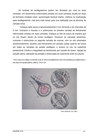 As incisões de esofagostomia podem ser fechadas por uma ou duas
camadas. Um fechamento interrompido simples em duas camadas resulta em força
de ferimento imediata maior, aproximação tecidual melhor, melhora na cicatrização
após esofagostomia, mas leva mais tempo para sua realização que as técnicas de
camada única.
Coloque cada sutura a aproximadamente 2 mm da borda e em intervalos de
2 mm. Incorpore a mucosa e a submucosa na primeira camada de fechamento
interrompido simples em duas camadas. Coloque os fios de sutura de maneira que
os nós fiquem dentro do lúmen esofágico. Incorpore as camadas adventícia,
muscular e submucosa na segunda camada de suturas, com os nós amarrados
extraluminalmente. Quando usar fechamento em camada, passe cada fio de sutura
por todas as camadas da parede esofágica, e amarre os nós na superfície
extraluminal. Confira a integridade do fechamento por oclusão do lúmen, injeção de
solução salina, aplicação de pressão e observação de vazamento entre as suturas.
* Para sutura do esôfago recomenda-se fio de sutura monofilamentar absorvível (polidaxona, poligliconato) e
não absorvível (polipropileno, náilon), 3-0 ou 4-0.
Fonte: FOSSUM, T.W., 2002.
_____________________________________________________________________________________
GALERA, P.D. 105
 