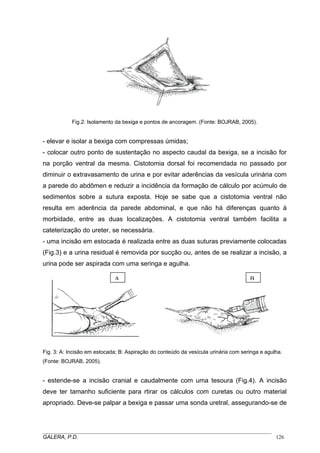 Fig.2: Isolamento da bexiga e pontos de ancoragem. (Fonte: BOJRAB, 2005).
- elevar e isolar a bexiga com compressas úmidas;
- colocar outro ponto de sustentação no aspecto caudal da bexiga, se a incisão for
na porção ventral da mesma. Cistotomia dorsal foi recomendada no passado por
diminuir o extravasamento de urina e por evitar aderências da vesícula urinária com
a parede do abdômen e reduzir a incidência da formação de cálculo por acúmulo de
sedimentos sobre a sutura exposta. Hoje se sabe que a cistotomia ventral não
resulta em aderência da parede abdominal, e que não há diferenças quanto à
morbidade, entre as duas localizações. A cistotomia ventral também facilita a
cateterização do ureter, se necessária.
- uma incisão em estocada é realizada entre as duas suturas previamente colocadas
(Fig.3) e a urina residual é removida por sucção ou, antes de se realizar a incisão, a
urina pode ser aspirada com uma seringa e agulha.
A B
Fig. 3: A: Incisão em estocada; B: Aspiração do conteúdo da vesícula urinária com seringa e agulha.
(Fonte: BOJRAB, 2005).
- estende-se a incisão cranial e caudalmente com uma tesoura (Fig.4). A incisão
deve ter tamanho suficiente para rtirar os cálculos com curetas ou outro material
apropriado. Deve-se palpar a bexiga e passar uma sonda uretral, assegurando-se de
_____________________________________________________________________________________
GALERA, P.D. 126
 