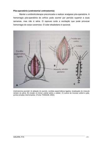 Pós-operatório (uretrotomia/ uretrostomia):
Manter a antibioticoterapia preconizada e realizar analgesia pós-operatória. A
hemorragia pós-operatória do orifício pode ocorrer por período superior a duas
semanas, mas não é séria. O repouso evita a excitação que pode provocar
hemorragia do corpo cavernoso. O colar elisabetano é opcional.
Uretrostomia escrotal: A) ablação do escroto, cordões espermáticos ligados, localização do músculo
retrator do pênis. B) incisão no lúmen uretral sobre o cateter. C) sutura da mucosa uretral à pele,
pontos simples interrompidos. (Fonte: FOSSUM, 2002).
_____________________________________________________________________________________
GALERA, P.D. 131
 