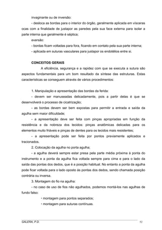 invaginante ou de inversão:
- desloca as bordas para o interior do órgão, geralmente aplicada em vísceras
ocas com a finalidade de justapor as paredes pela sua face externa para isolar a
parte interna que geralmente é séptica;
eversão:
- bordas ficam voltadas para fora, ficando em contato pela sua parte interna;
- aplicada em suturas vasculares para justapor os endotélios entre si.
CONCEITOS GERAIS
A eficiência, segurança e a rapidez com que se executa a sutura são
aspectos fundamentais para um bom resultado da síntese das estruturas. Estas
características se conseguem através de vários procedimentos:
1. Manipulação e apresentação das bordas da ferida:
- devem ser manuseadas delicadamente, pois a partir delas é que se
desenvolverá o processo de cicatrização;
- as bordas devem ser bem expostas para permitir a entrada e saída da
agulha sem maior dificuldade;
- a apresentação deve ser feita com pinças apropriadas em função da
resistência e da nobreza dos tecidos: pinças anatômicas delicadas para os
elementos muito friáveis e pinças de dentes para os tecidos mais resistentes;
- a apresentação pode ser feita por pontos previamente aplicados e
tracionados.
2. Colocação da agulha no porta agulha;
- a agulha deverá sempre estar presa pela parte média próxima à ponta do
instrumento e a ponta da agulha fica voltada sempre para cima e para o lado da
saída das pontas dos dedos, que é a posição habitual. No entanto a ponta da agulha
pode ficar voltada para o lado oposto às pontas dos dedos, sendo chamada posição
contrária ou inversa.
3. Montagem do fio na agulha:
- no caso de uso de fios não agulhados, podemos montá-los nas agulhas de
fundo falso:
montagem para pontos separados;
montagem para suturas contínuas.
_____________________________________________________________________________________
GALERA, P.D. 52
 