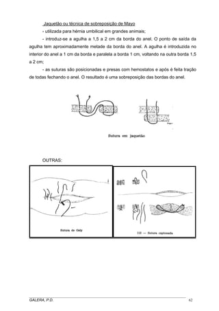 Jaquetão ou técnica de sobreposição de Mayo
- utilizada para hérnia umbilical em grandes animais;
- introduz-se a agulha a 1,5 a 2 cm da borda do anel. O ponto de saída da
agulha tem aproximadamente metade da borda do anel. A agulha é introduzida no
interior do anel a 1 cm da borda e paralela a borda 1 cm, voltando na outra borda 1,5
a 2 cm;
- as suturas são posicionadas e presas com hemostatos e após é feita tração
de todas fechando o anel. O resultado é uma sobreposição das bordas do anel.
OUTRAS:
_____________________________________________________________________________________
GALERA, P.D. 62
 