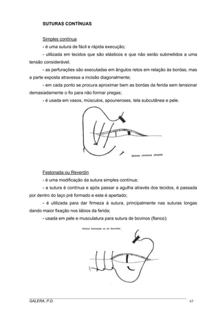 SUTURAS CONTÍNUAS
Simples contínua
- é uma sutura de fácil e rápida execução;
- utilizada em tecidos que são elásticos e que não serão submetidos a uma
tensão considerável;
- as perfurações são executadas em ângulos retos em relação às bordas, mas
a parte exposta atravessa a incisão diagonalmente;
- em cada ponto se procura aproximar bem as bordas da ferida sem tensionar
demasiadamente o fio para não formar pregas;
- é usada em vasos, músculos, apouneroses, tela subcutânea e pele.
Festonada ou Reverdin
- é uma modificação da sutura simples contínua;
- a sutura é contínua e após passar a agulha através dos tecidos, é passada
por dentro do laço pré formado e este é apertado;
- é utilizada para dar firmeza à sutura, principalmente nas suturas longas
dando maior fixação nos lábios da ferida;
- usada em pele e musculatura para sutura de bovinos (flanco);
_____________________________________________________________________________________
GALERA, P.D. 63
 