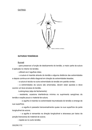 OUTRAS:
SUTURAS TENDÍNEAS
Bunnell
- para preservar a função de deslizamento do tendão, a maior parte da sutura
é aplicada no interior do tendão;
- utilizam-se 2 agulhas retas;
- a sutura é inserida através do tendão a alguma distância das extremidades
e depois continua em efeito diagonal em direção às extremidades lesadas;
- a sutura é tecida na outra extremidade do tendão em padrão similar;
- a extremidades da sutura são amarradas, devem estar apostas e deve
ocorrer um leve encaixe do tendão.
Locking-loop (alça de fechamento)
- resistente, ocasiona interferência mínima no suprimento sangüíneo do
tendão e expõe pouco o material de sutura;
- a agulha é inserida na extremidade traumatizada do tendão e emerge de
sua superfície;
- a agulha é passada transversalmente quase na sua superfície da parte
longitudinal da sutura;
- a agulha é reinserida na direção longitudinal e atravessa por baixo da
porção transversa do material de sutura;
- repete-se no outro tendão;
_____________________________________________________________________________________
GALERA, P.D. 67
 