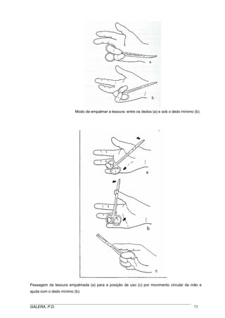 Modo de empalmar a tesoura: entre os dedos (a) e sob o dedo mínimo (b).
Passagem da tesoura empalmada (a) para a posição de uso (c) por movimento circular da mão e
ajuda com o dedo mínimo (b).
_____________________________________________________________________________________
GALERA, P.D. 73
 