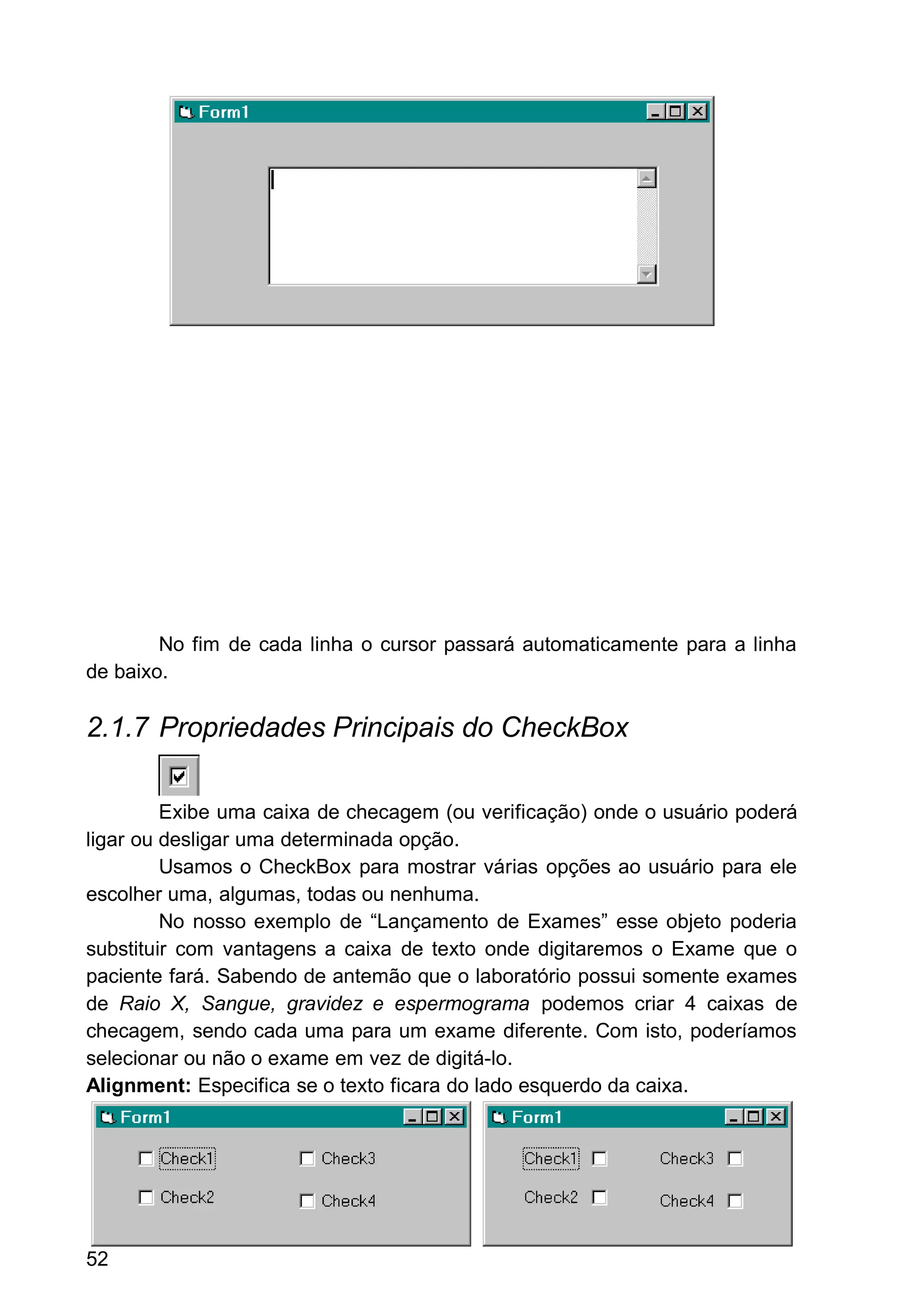 No fim de cada linha o cursor passará automaticamente para a linha
de baixo.
2.1.7 Propriedades Principais do CheckBox
Exibe uma caixa de checagem (ou verificação) onde o usuário poderá
ligar ou desligar uma determinada opção.
Usamos o CheckBox para mostrar várias opções ao usuário para ele
escolher uma, algumas, todas ou nenhuma.
No nosso exemplo de “Lançamento de Exames” esse objeto poderia
substituir com vantagens a caixa de texto onde digitaremos o Exame que o
paciente fará. Sabendo de antemão que o laboratório possui somente exames
de Raio X, Sangue, gravidez e espermograma podemos criar 4 caixas de
checagem, sendo cada uma para um exame diferente. Com isto, poderíamos
selecionar ou não o exame em vez de digitá-lo.
Alignment: Especifica se o texto ficara do lado esquerdo da caixa.
52
 