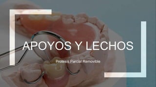 APOYOS Y LECHOS
Protesis Parcial Removible
 