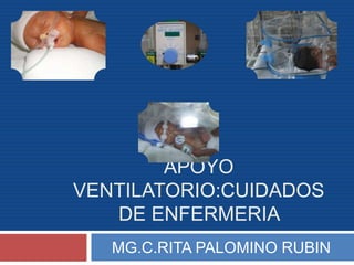 APOYO
VENTILATORIO:CUIDADOS
DE ENFERMERIA
MG.C.RITA PALOMINO RUBIN
 