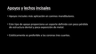 • Apoyos incisales más aplicación en caninos mandibulares.
• Este tipo de apoyo proporciona un soporte definido con poca pérdida
de estructura dental y poca exposición de metal.
• Estéticamente es preferible a las coronas tres cuartos.
 