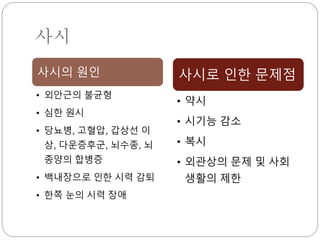 사시
사시의 원인
• 외안근의 불균형
• 심한 원시
• 당뇨병, 고혈압, 갑상선 이
상, 다운증후군, 뇌수종, 뇌
종양의 합병증
• 백내장으로 인한 시력 감퇴
• 한쪽 눈의 시력 장애
사시로 인한 문제점
• 약시
• 시기능 감소
• 복시
• 외관상의 문제 및 사회
생활의 제한
 