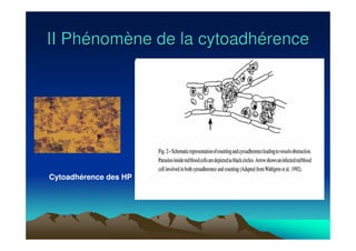 II PhII Phéénomnomèène de la cytoadhne de la cytoadhéérencerence
Cytoadhérence des HP
 