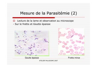 ATELIER PALUDISME 2007
Mesure de la Parasitémie (2)
Lecture de la lame et observation au microscope
- Sur le frottis et Goutte épaisse
Goutte épaisse Frottis mince
 