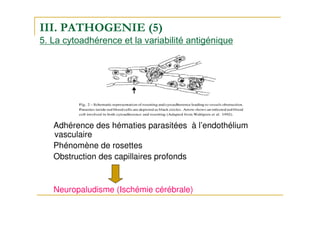 III. PATHOGENIE (5)
5. La cytoadhérence et la variabilité antigénique
Adhérence des hématies parasitées à l’endothélium
vasculaire
Phénomène de rosettes
Obstruction des capillaires profonds
Neuropaludisme (Ischémie cérébrale)
 