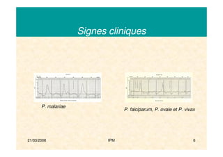 21/03/2008 IPM 6
Signes cliniques
P. malariae
P. falciparum, P. ovale et P. vivax
 