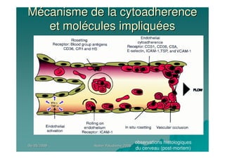 06/05/200806/05/2008 Atelier Paludisme 2008Atelier Paludisme 2008
MMéécanisme de la cytoadherencecanisme de la cytoadherence
et molet moléécules impliqucules impliquééeses
observations histologiques
du cerveau (post-mortem)
 