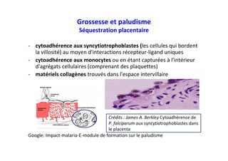 Grossesse et paludisme
Séquestration placentaire
- cytoadhérence aux syncytiotrophoblastes (les cellules qui bordent
la villosité) au moyen d'interactions récepteur-ligand uniques
- cytoadhérence aux monocytes ou en étant capturées à l'intérieur
d'agrégats cellulaires (comprenant des plaquettes)
- matériels collagènes trouvés dans l'espace intervillaire
Google: Impact-malaria-E-module de formation sur le paludisme
Crédits : James A. Berkley Cytoadhérence de
P. falciparum aux syncytiotrophoblastes dans
le placenta
 