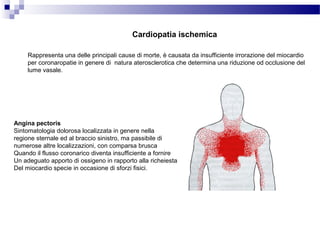 Cardiopatia ischemica
Rappresenta una delle principali cause di morte, è causata da insufficiente irrorazione del miocardio
per coronaropatie in genere di natura aterosclerotica che determina una riduzione od occlusione del
lume vasale.
Angina pectoris
Sintomatologia dolorosa localizzata in genere nella
regione sternale ed al braccio sinistro, ma passibile di
numerose altre localizzazioni, con comparsa brusca
Quando il flusso coronarico diventa insufficiente a fornire
Un adeguato apporto di ossigeno in rapporto alla richeiesta
Del miocardio specie in occasione di sforzi fisici.
 
