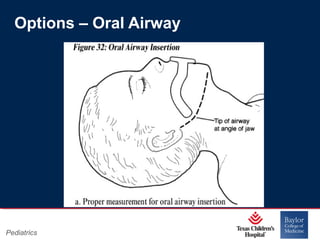 Options – Oral Airway

Pediatrics

Page 10
xxx00.#####.ppt 11/14/13 09:29 PM

 