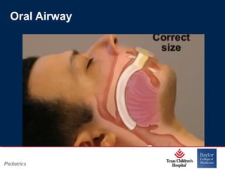 Oral Airway

Pediatrics

Page 11
xxx00.#####.ppt 11/14/13 09:29 PM

 