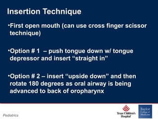 Insertion Technique
•First open mouth (can use cross finger scissor
technique)
•Option # 1 – push tongue down w/ tongue
depressor and insert “straight in”
•Option # 2 – insert “upside down” and then
rotate 180 degrees as oral airway is being
advanced to back of oropharynx

Pediatrics

Page 14
xxx00.#####.ppt 11/14/13 09:29 PM

 