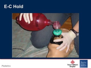 E-C Hold

Pediatrics

Page 23
xxx00.#####.ppt 11/14/13 09:29 PM

 