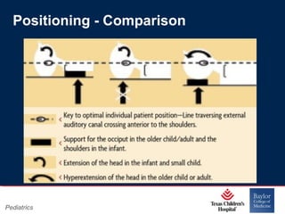 Positioning - Comparison

Pediatrics

Page 5
xxx00.#####.ppt 11/14/13 09:29 PM

 