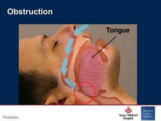 Obstruction

Pediatrics

Page 6
xxx00.#####.ppt 11/14/13 09:29 PM

 