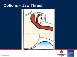 Options – Jaw Thrust

Pediatrics

Page 8
xxx00.#####.ppt 11/14/13 09:29 PM

 