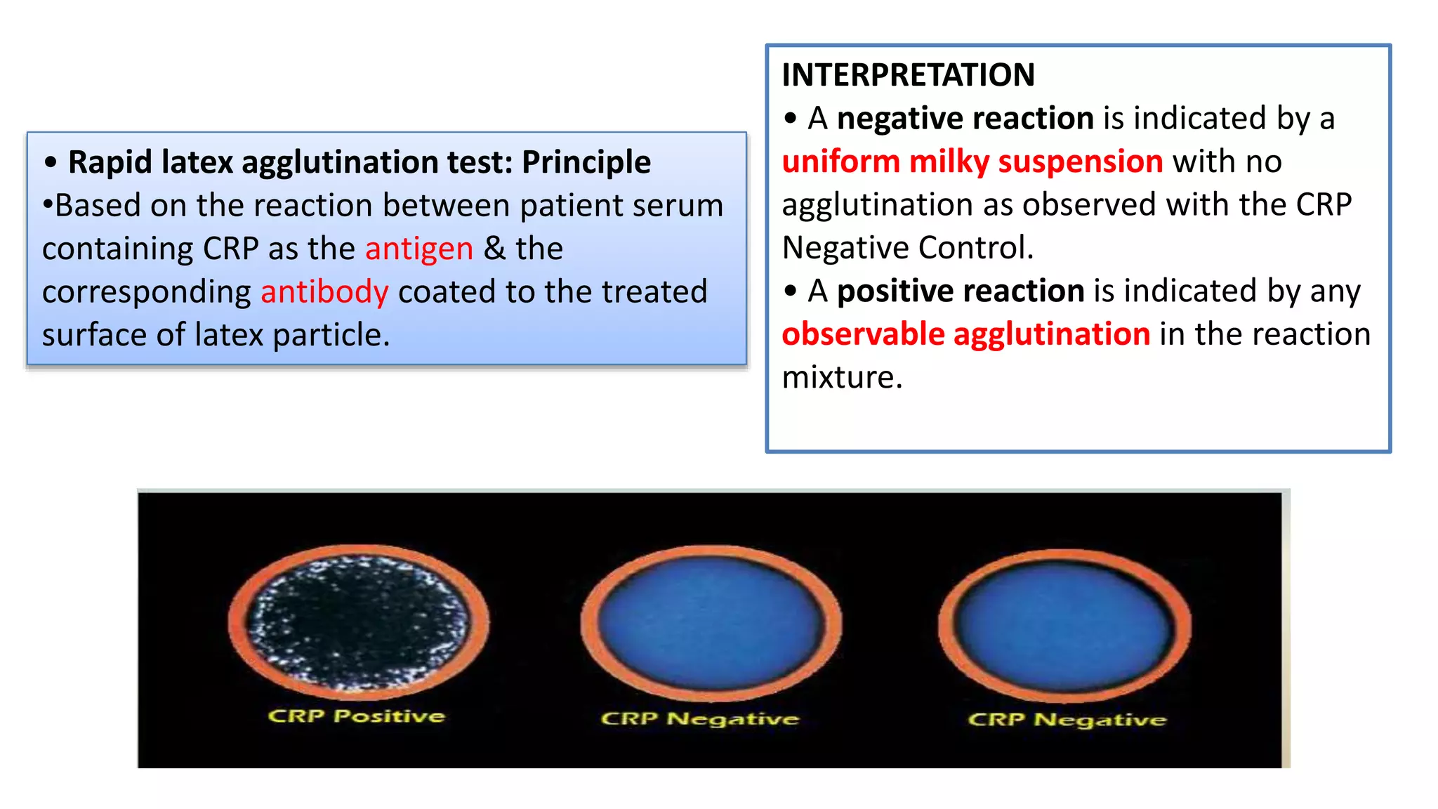 Acute phase proteins | PPTX