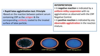 • Rapid latex agglutination test: Principle
•Based on the reaction between patient serum
containing CRP as the antigen & the
corresponding antibody coated to the treated
surface of latex particle.
INTERPRETATION
• A negative reaction is indicated by a
uniform milky suspension with no
agglutination as observed with the CRP
Negative Control.
• A positive reaction is indicated by any
observable agglutination in the reaction
mixture.
 
