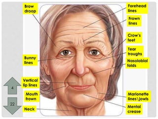 Brow 
droop 
Bunny 
lines 
Forehead 
lines 
Frown 
lines 
Vertical 
lip lines 
Mouth 
frown 
Neck 
Crow’s 
feet 
Tear 
troughs 
Nasolabial 
folds 
Marionette 
linesjowls 
Mental 
crease 
4 
22 
 
