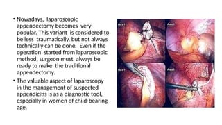 Appendectomy.pptx procedures laprascopic and open methods | PPTX