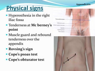 Appendicitis

Physical signs
 Hyperesthesia in the right
  iliac fossa
 Tenderness at Mc berney’s
  point
 Muscle guard and rebound
  tenderness over the
  appendix
 Rovsing’s sign
 Cope’s psoas test
 Cope’s obturator test
 