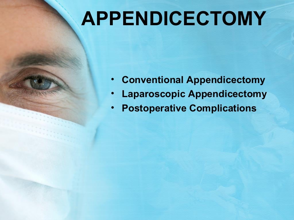 Appendicectomy