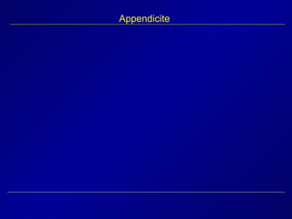 Appendicite 