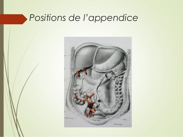 De Quel Côté Se Trouve L Appendice – ZRPIV