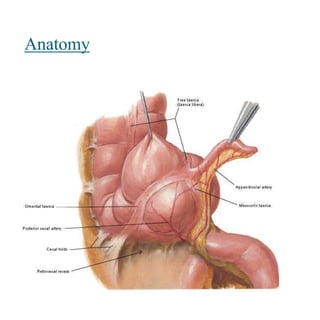 Appendicitis | PPTX