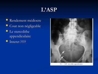 L’ASP
L’ASP
 Rendement médiocre
Rendement médiocre
 Cout non négligeable
Cout non négligeable
 Le stercolithe
Le stercolithe
appendiculaire
appendiculaire
 Interet ????
Interet ????
 