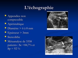L’échographie
L’échographie
 Appendice non
Appendice non
compressible
compressible
 Apéristaltique
Apéristaltique
 Diamètre > 6 à 8 mm
Diamètre > 6 à 8 mm
 Epaisseur > 3mm
Epaisseur > 3mm
 Stercolithe
Stercolithe
 Métaanalyse de 3358
Métaanalyse de 3358
patients : Se =84,7% et
patients : Se =84,7% et
Sp = 92 %
Sp = 92 %
 